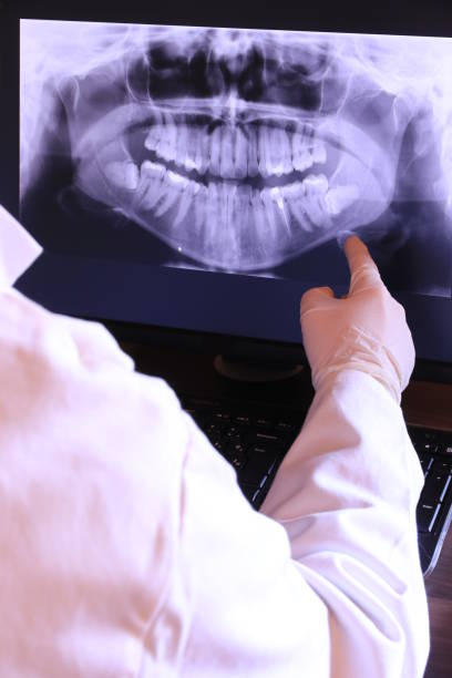 Best Emergency Wisdom Teeth Removal in La Blanca, TX